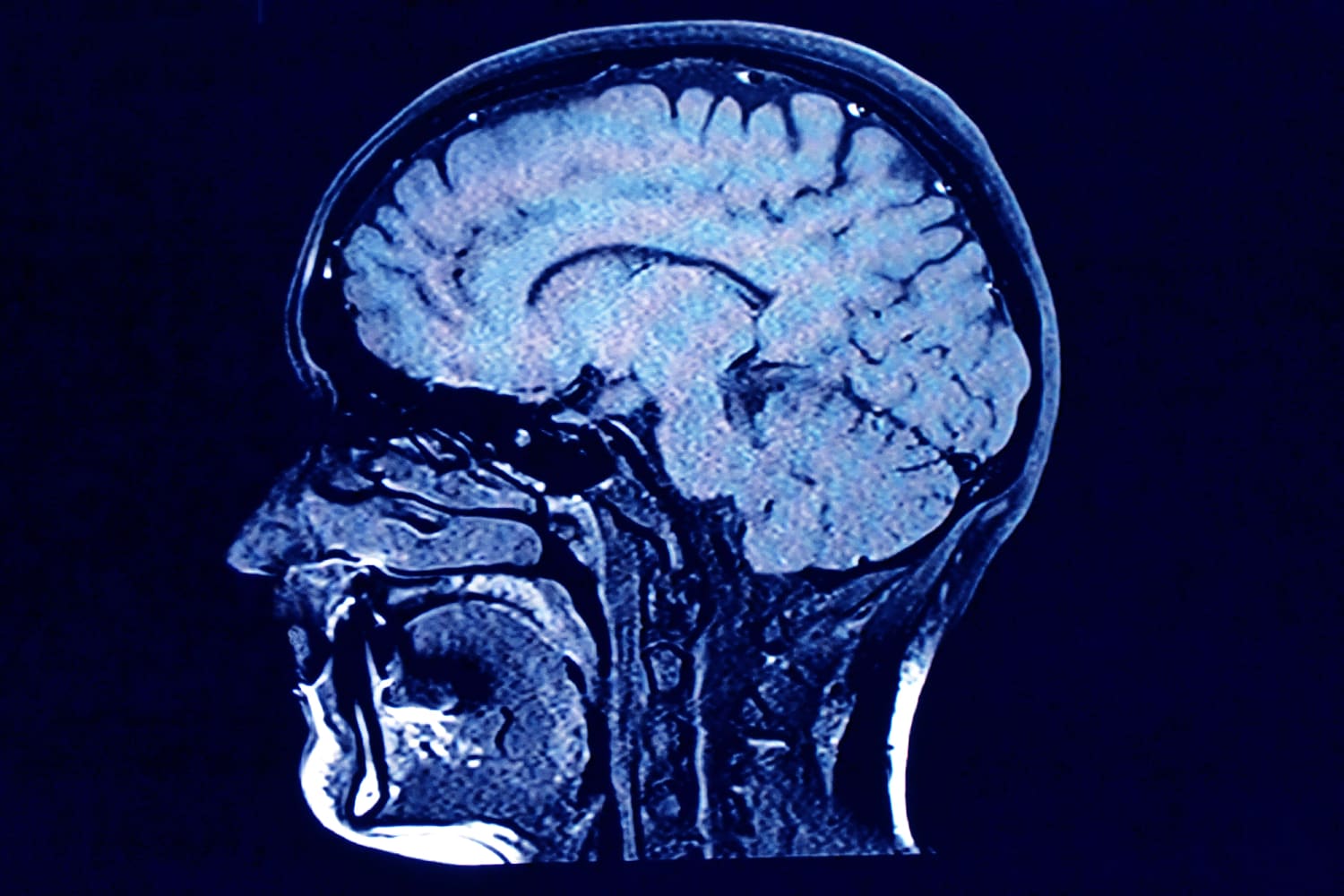 Blue-toned brain MRI image used as a curiosity visual for a sound-based wellness idea